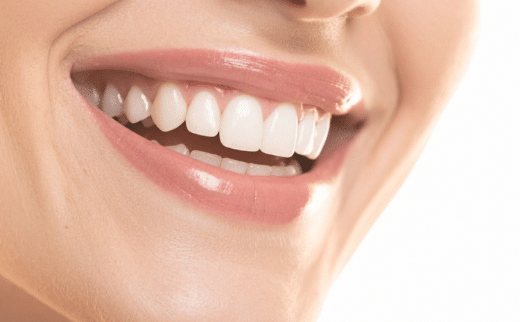 Действительно ли отбеливание вредит эмали? Развенчиваем мифы
